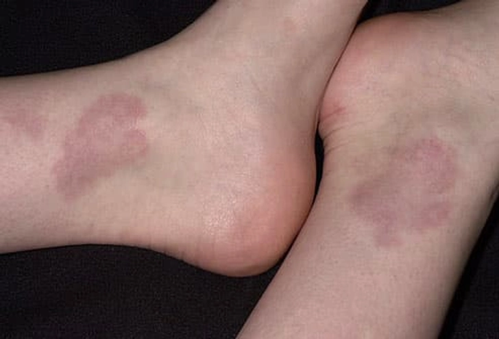 Not All Skin Conditions Scary