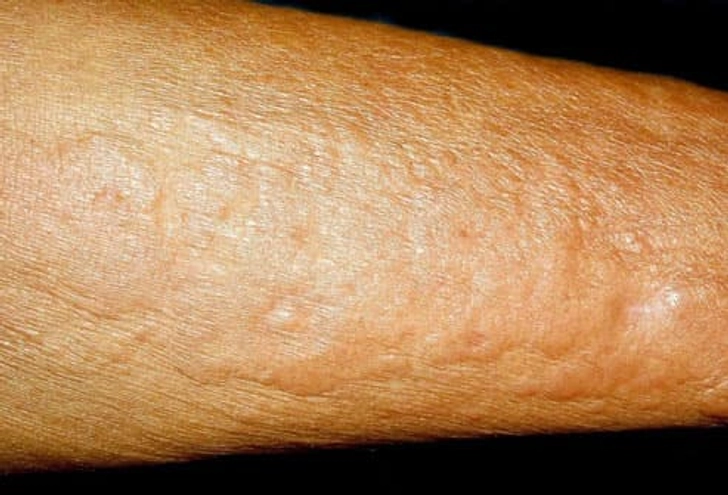 'Wooden' Hands and Feet