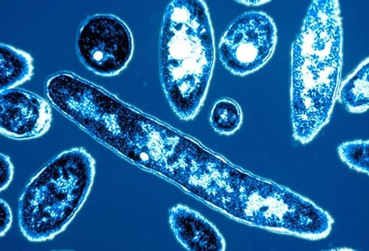 Legionnaire’s Disease Legionnaire’s Disease