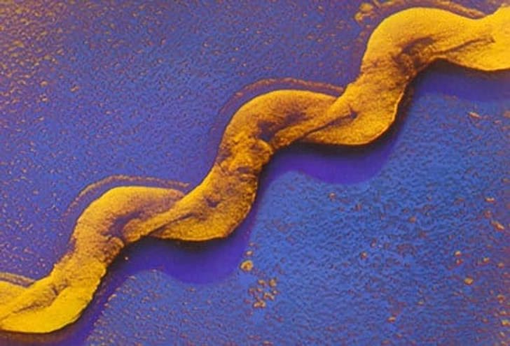 Leptospirosis