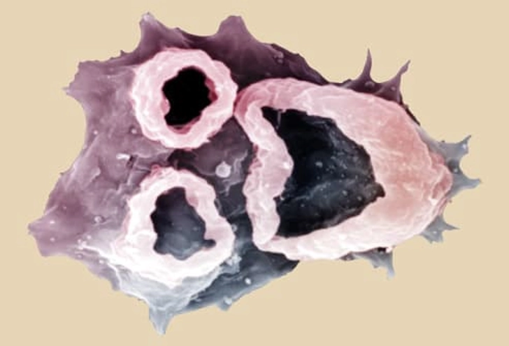 Naegleria fowleri Naegleria fowleri