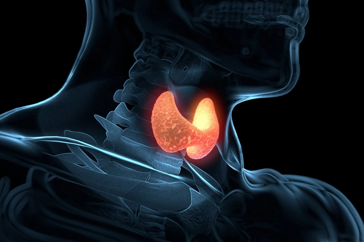 Overactive thyroid