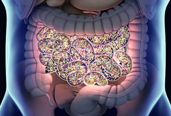 Too Much Gut Bacteria