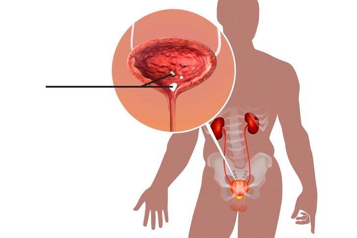 Bladder