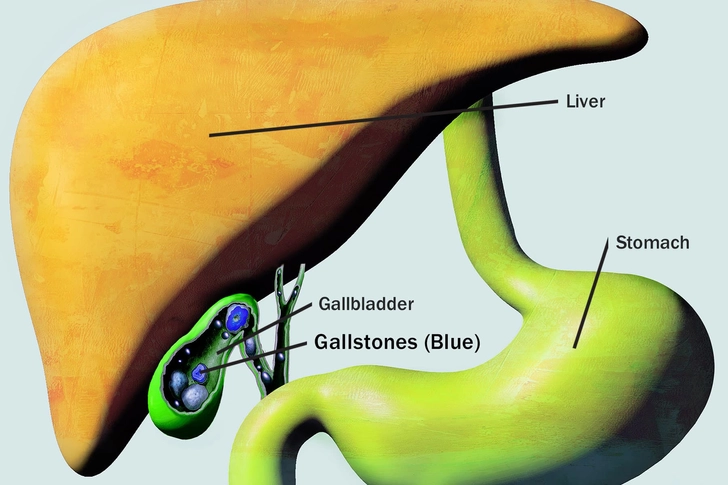 Gallbladder