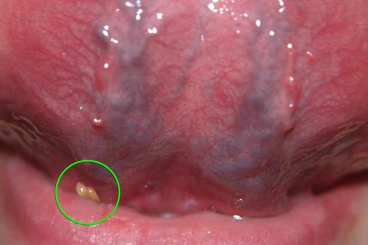 Mouth