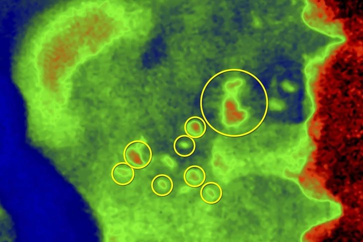 Pancreas