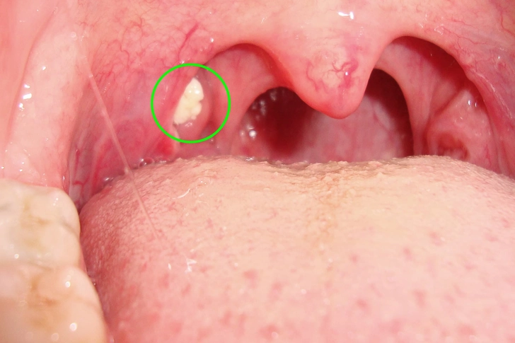 Throat