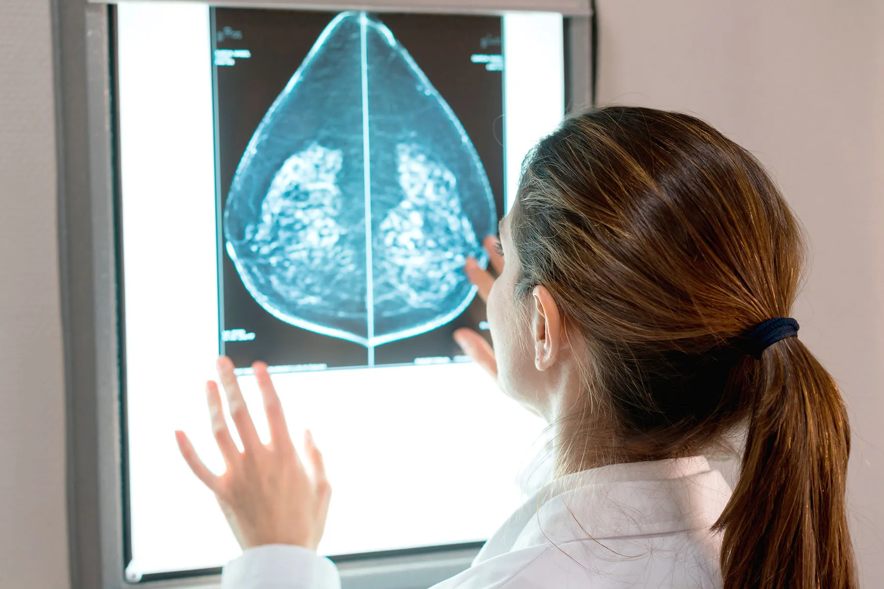 Deciding Factors for Treatment