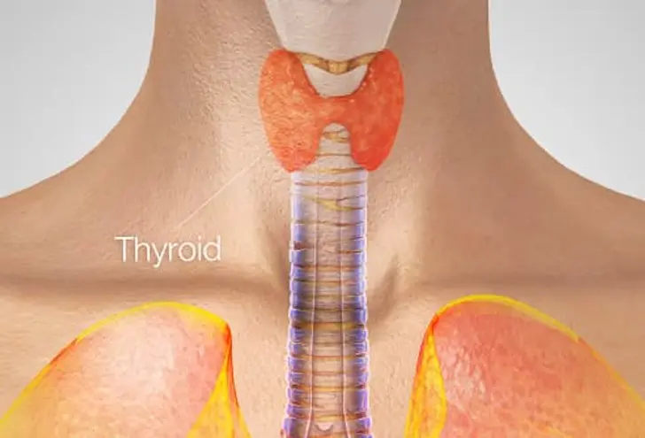Hyperthyroidism Hyperthyroidism