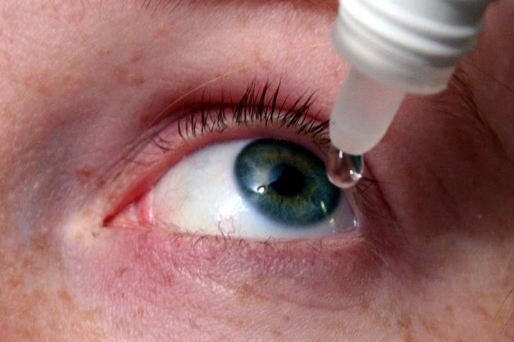 Sjogren’s Syndrome