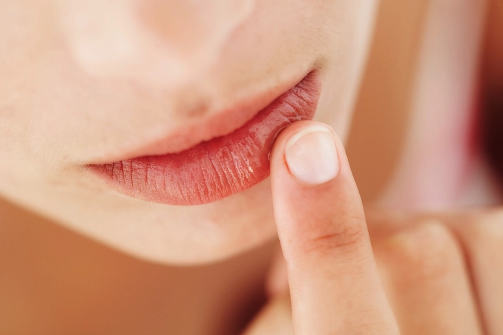 Dry Mouth