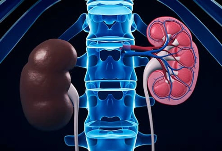 Kidney Disease