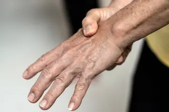 photo of tingling hands
