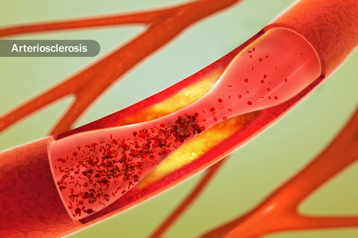 Blood Flow Problem