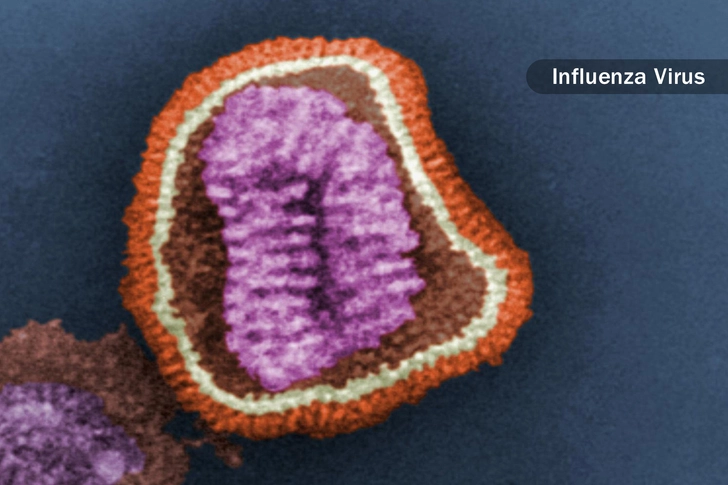 The Flu or Other Infections