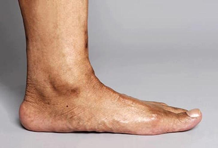 Flat Feet Flat Feet
