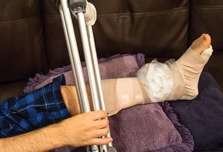 Sprained Ankle