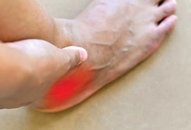 Chronic Lateral Ankle Pain
