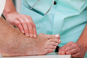 Bunion