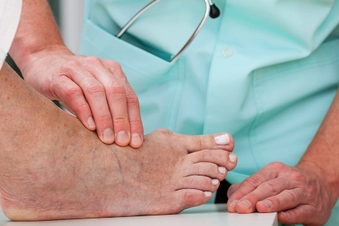 Bunion Bunion