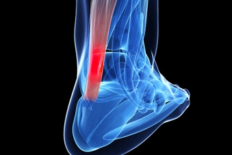 Achilles Problems Achilles Problems
