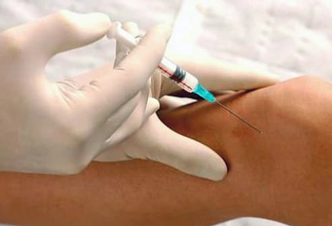 Treating Osteoarthritis Treating Osteoarthritis