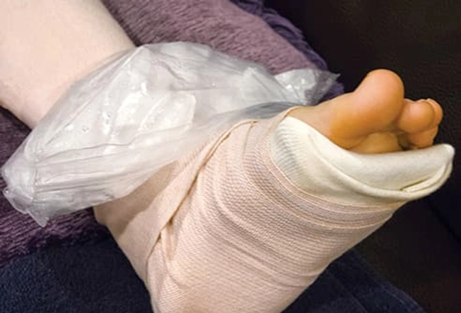 Treating a Joint Injury Treating a Joint Injury