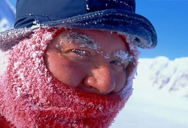 Be Alert for Frostbite Be Alert for Frostbite