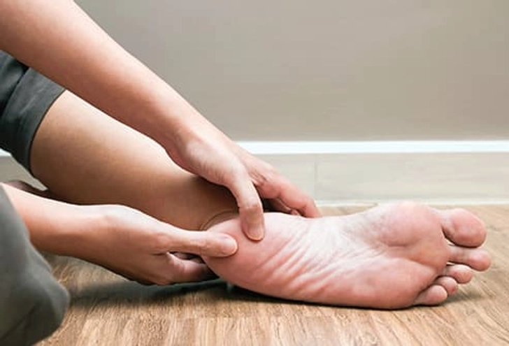 Plantar Fasciitis Plantar Fasciitis
