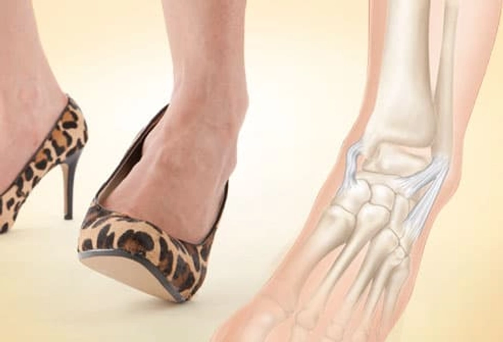 Problem: Ankle Sprains