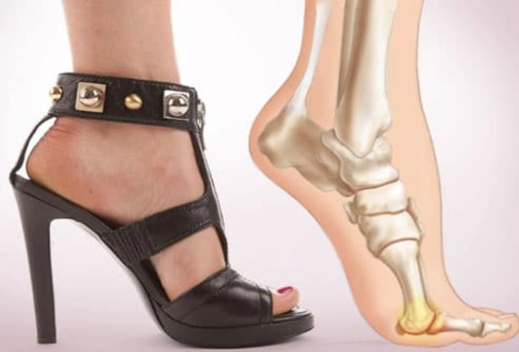 Problem: Unnatural Foot Position