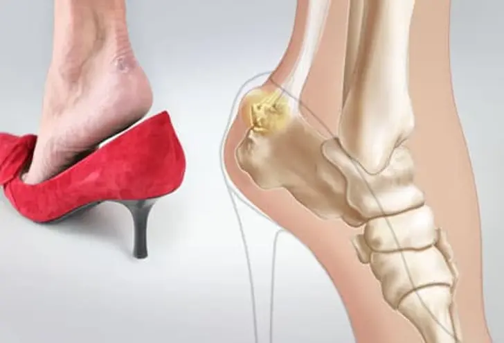 High Heels