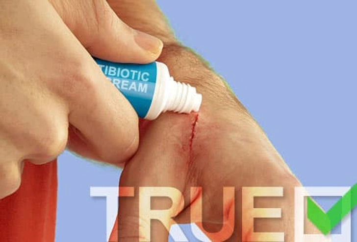 Keep Injuries Moist? TRUE Keep Injuries Moist? TRUE