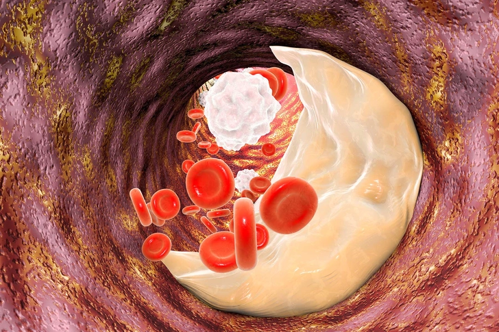 Replace Saturated Fats Replace Saturated Fats