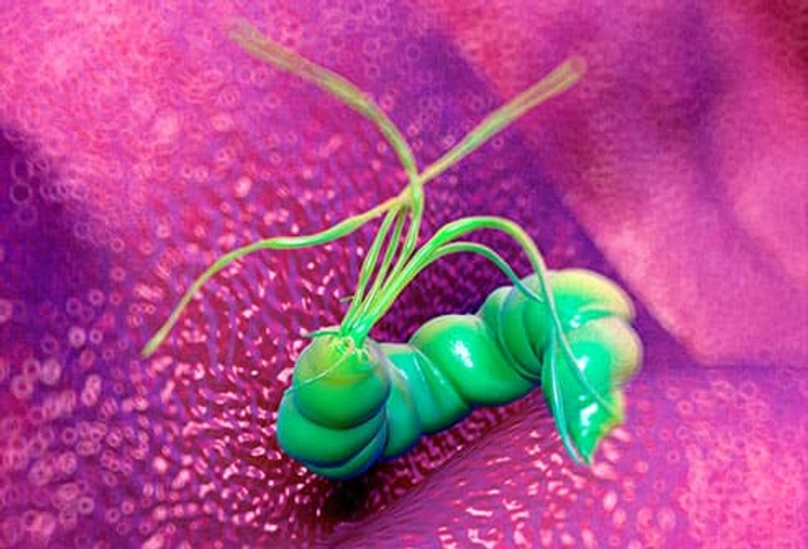 H. Pylori