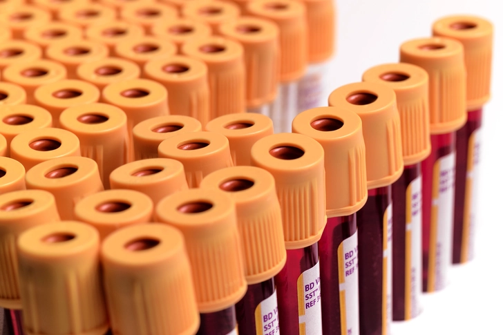 Low Levels of Blood Platelets Low Levels of Blood Platelets
