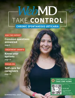 ChronicSpontaneousUrticaria_16PG_Guide_TC_Jul2025_Cover