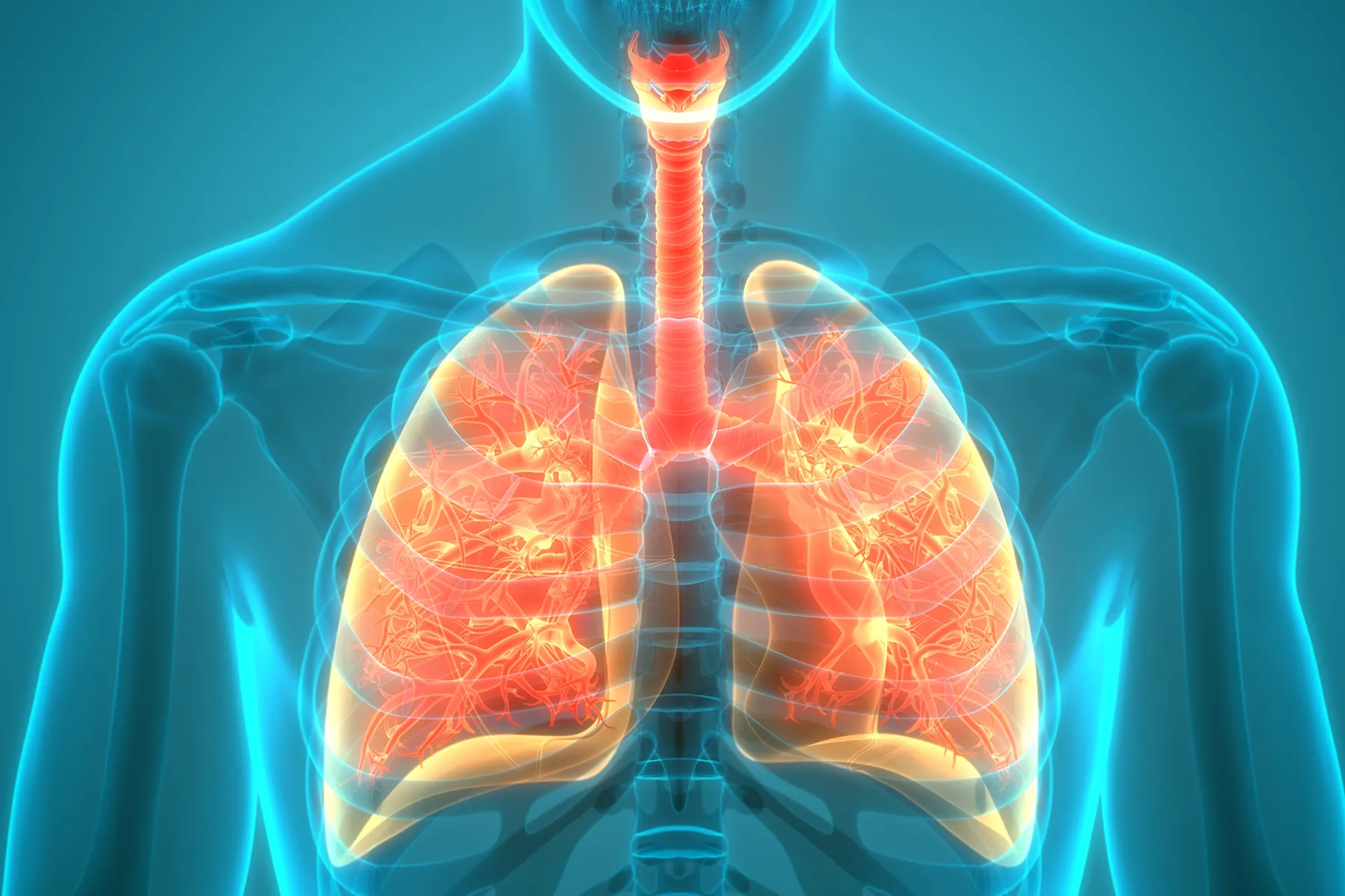 COPD Stages and the GOLD Criteria