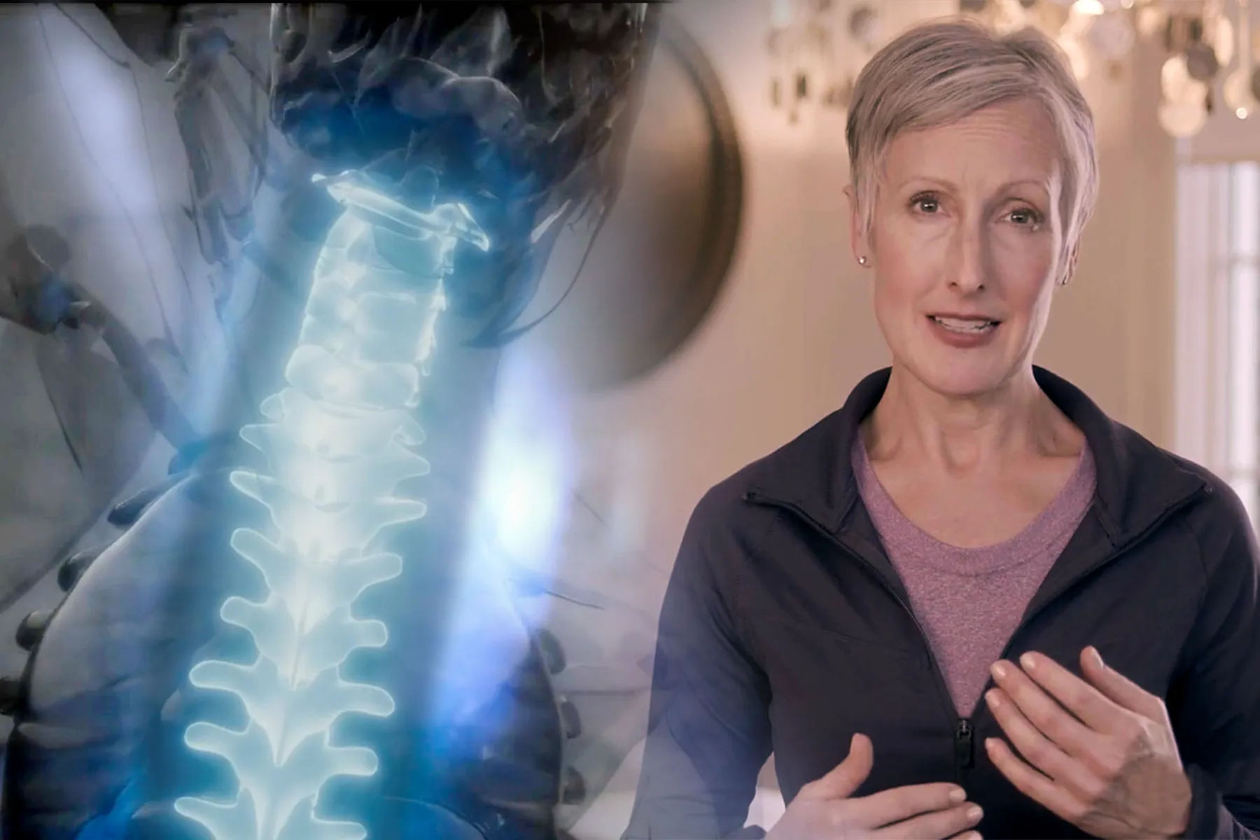 Exercises for Ankylosing Spondylitis